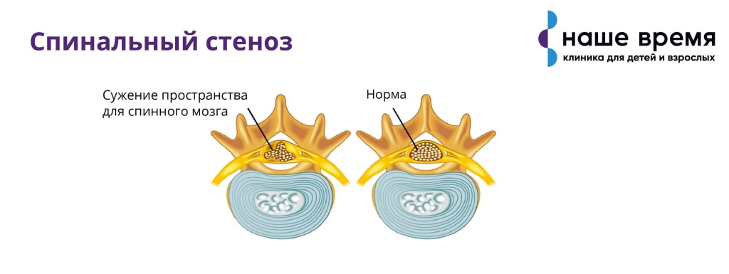 Что делать, если болит поясница?