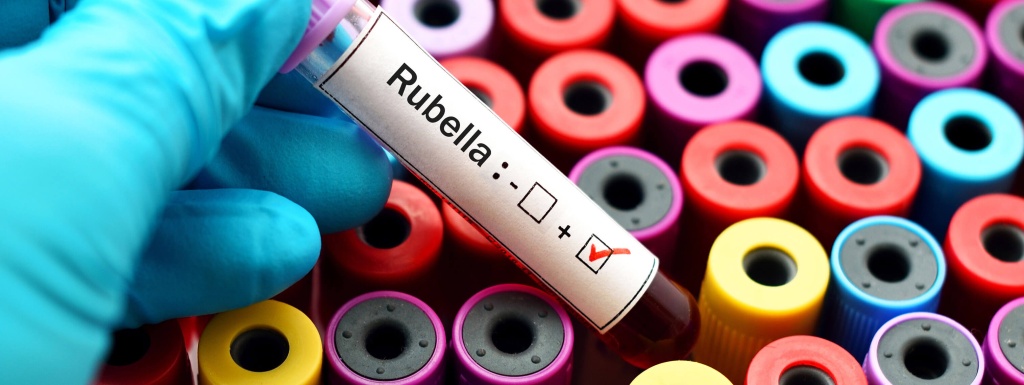 Чем опасна Краснуха (Rubella)?