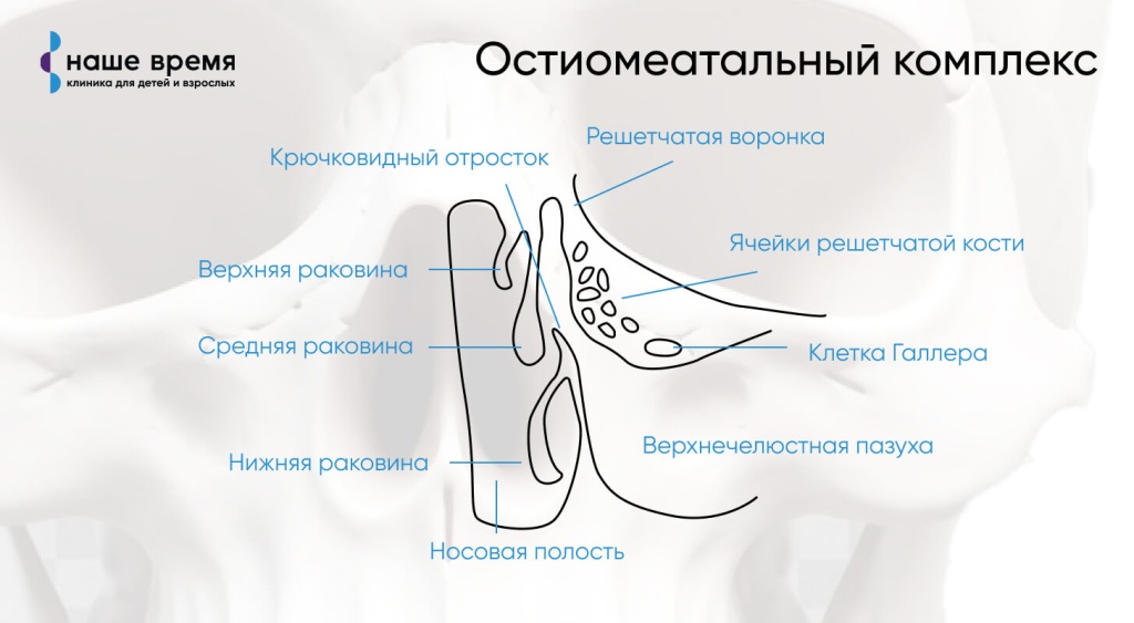 Как лечить гайморит в домашних условиях?